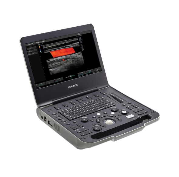 초음파영상진단장치<br>ALPNLON X-CUBE i8