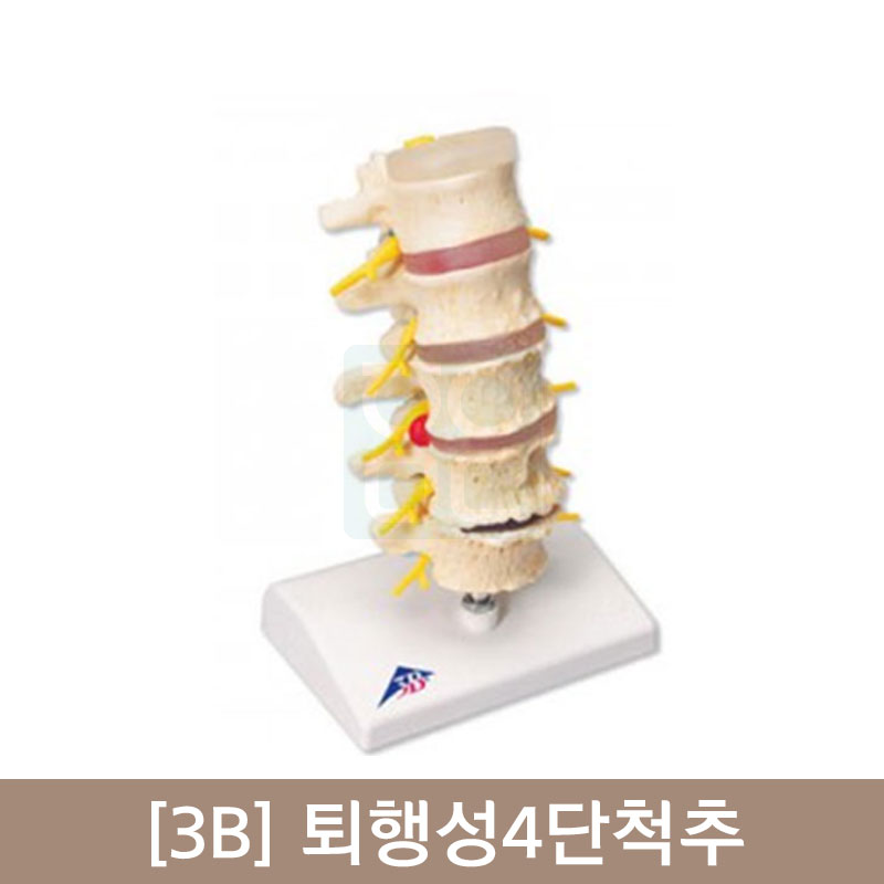 [3B]퇴행성4단척추<br>A795