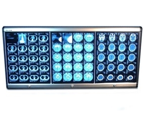 슬림형뷰박스3면<br>DILos-300