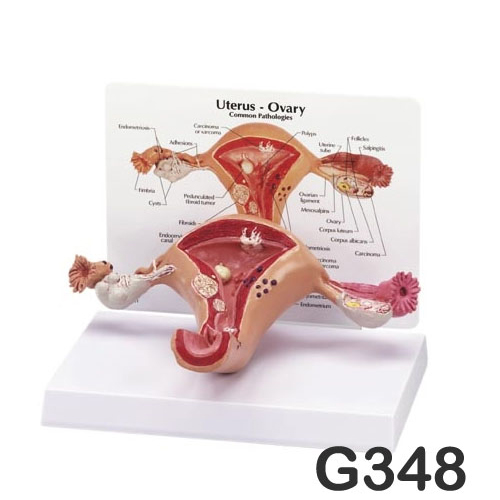 [GPI]자궁모형<br>G348
