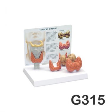 [GPI]갑상선질환모형<br>G315
